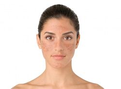 #2