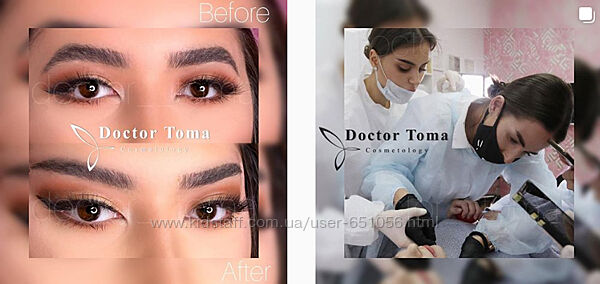 Курс Контурная пластика лица и тела Тариф Все 3 дня Тома Рязанцева