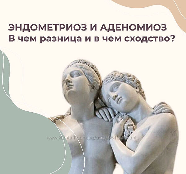 Эндометриоз Элисо Джобава