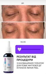 Пилинг под глаза RENEW разлив , распив