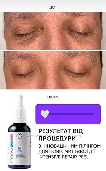 Пилинг под глаза RENEW разлив , распив