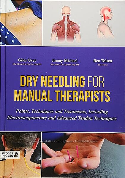 Dry Needling for Manual Therapists Giles Gyer Jimmy Michael