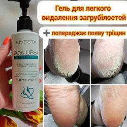 Гель-кератолітик для видалення мозолів і натоптишів, огрубінь на стопах