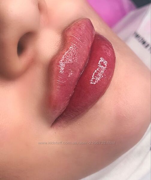 Курс по контурной пластике губ Расита Хапачева drkhapacheva