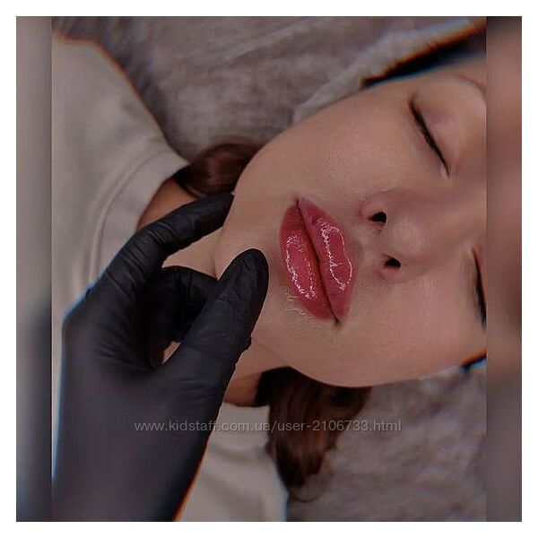 Контурная пластика губ длинной иглой Расита Хапачева