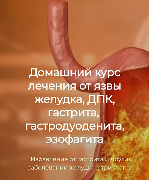 Игорь Кауфман Домашний курс лечения от язвы желудка, ДПК, гастрита 2024