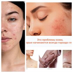 Лечебное питание в косметологии Юлия Резникова онлайн курс