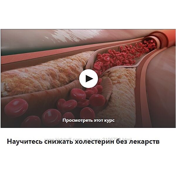 Udemy Научитесь снижать холестерин без лекарств Михаил Петрик